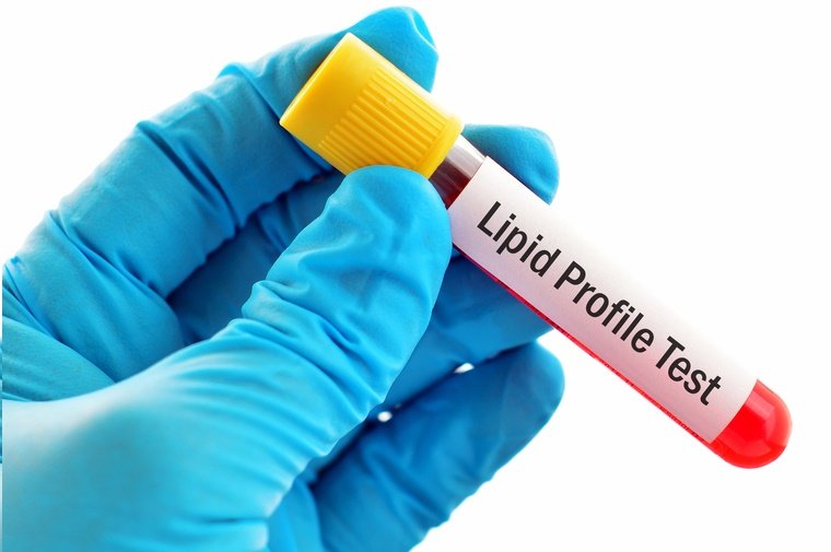 Lipid