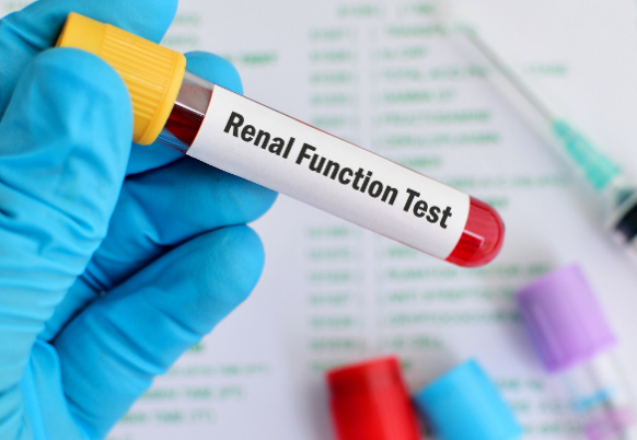Renal-Function-test-768x604